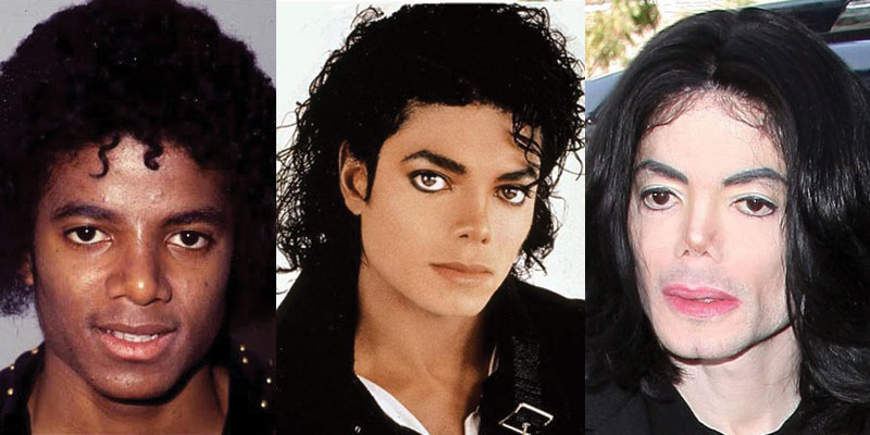 Зачем Майклу Джексону нужна была пластика, и какой бы была его жизнь без нее?