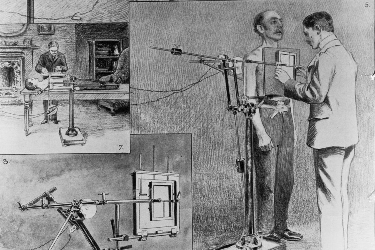  Открытие рентгеновских лучей (1895)