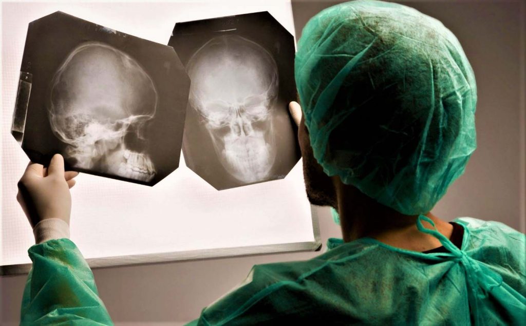 5 страшных фактов о черепно-мозговых травмах